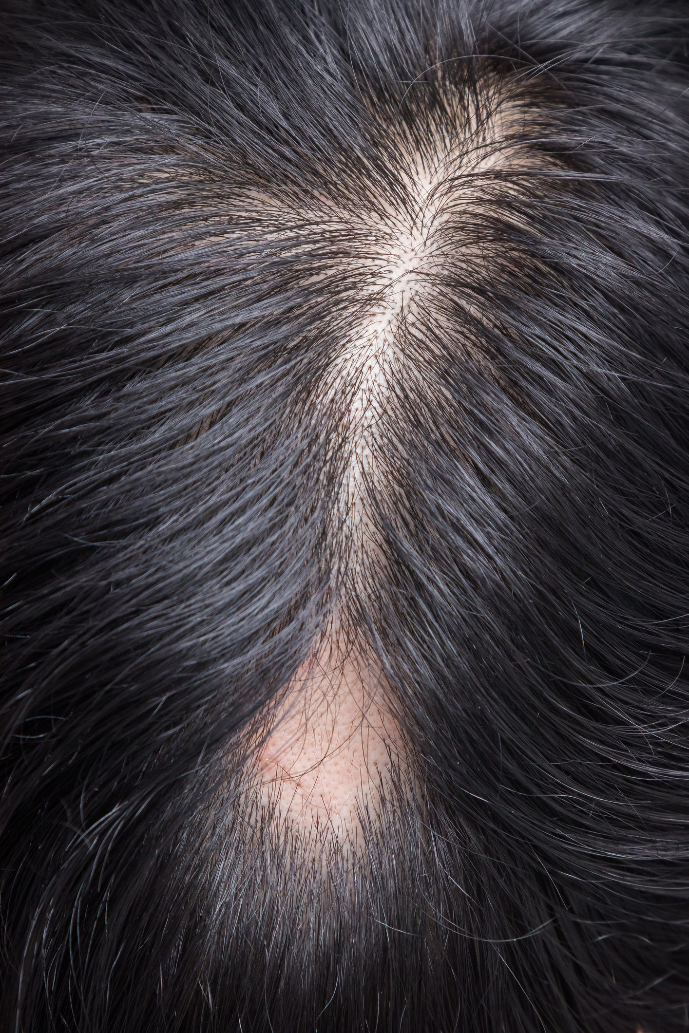 iStock 1264331091
